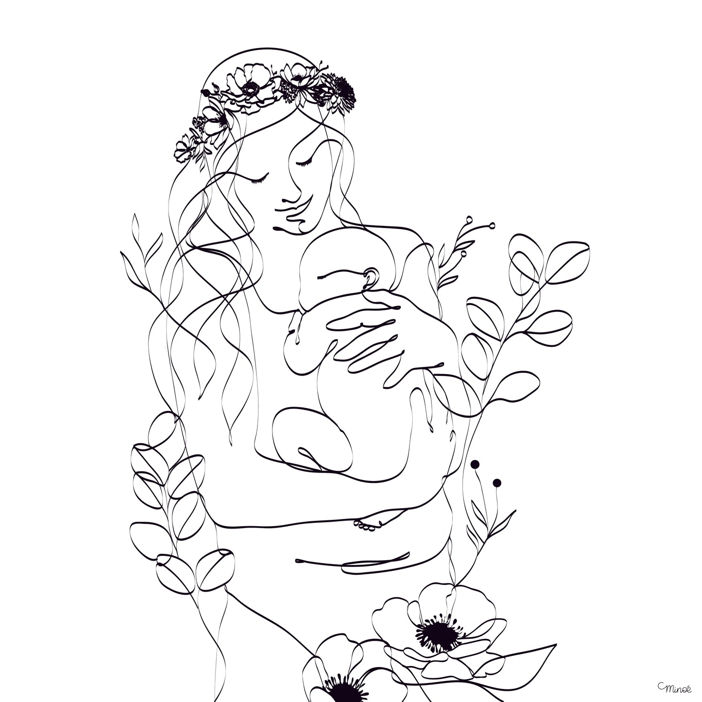 Illustration césarienne - modèle 1