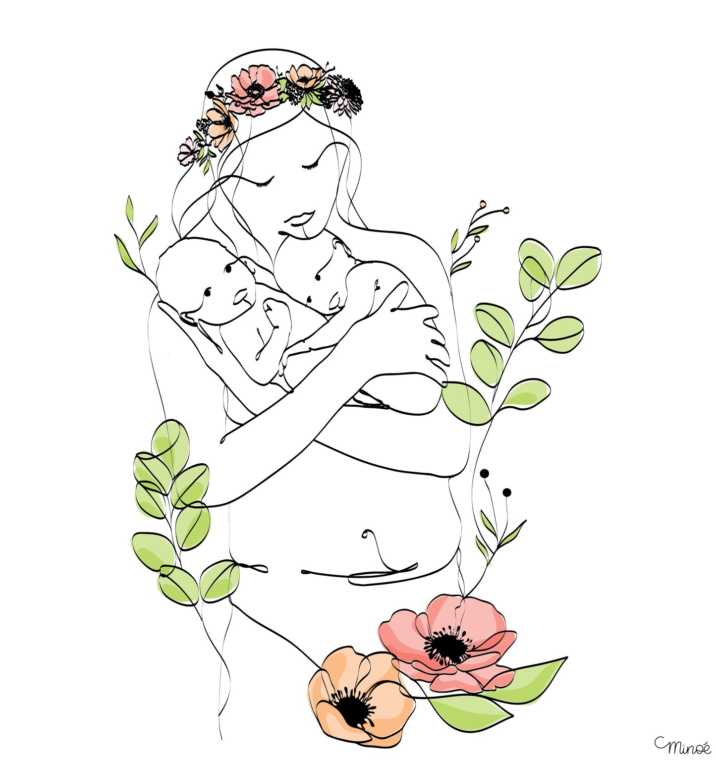 Illustration césarienne - modèle 1